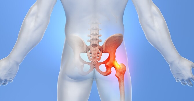 Hidden Connection Between Back and Hip Pain image